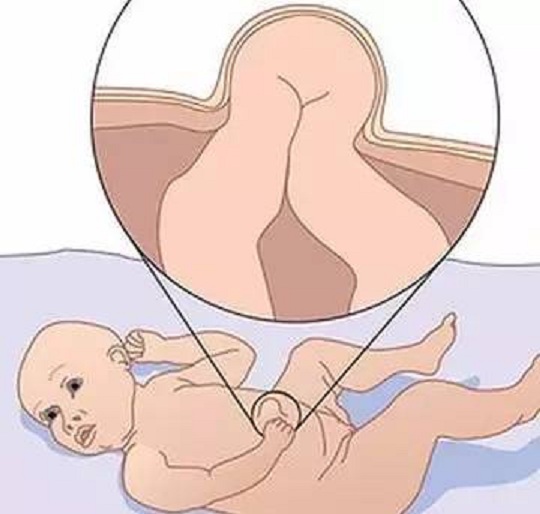 孩子哭闹不止却找不到原因