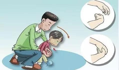 生活中一个小东西，就可以夺取孩子的生命！快过年了，千万注意
